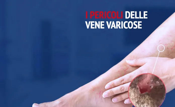 Varitone : composizione solo ingredienti naturali.